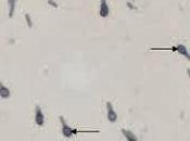 Impactos habilidad para formar endosporas