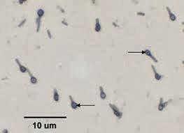 Esporas bacterianas, endosporas vs esporas reproductivas ¿cuál es la diferencia?