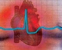 Muere jugando al fútbol joven de 18 años en Huixcolotla (México)