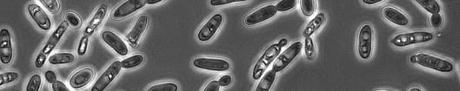 brettanomyces