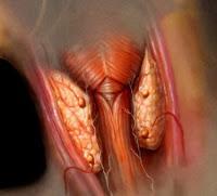 HIPERPARATIROIDISMO SECUNDARIO A ERC.