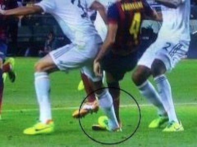 La verdad sobre el caso Undiano