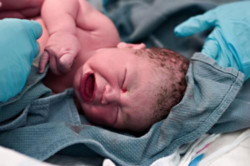 Bebés prematuros en los países en vías de desarrollo