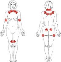 FIBROMIALGIA/ PASTELITOS DE PAPA Y PALTA