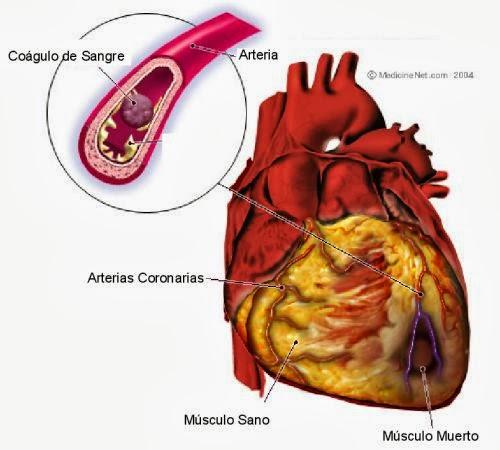 Cardiopatías ¿qué son y cómo tratarlas?