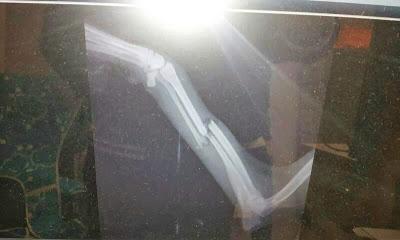 MUY URGENTE, GALGO CON LA PATA DESTROZADA!! PERRERA DE HELLÍN.