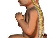 Smartsalus apoyando mundial Espina Bífida