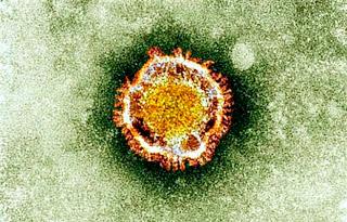 Detectado un caso del nuevo coronavirus en España