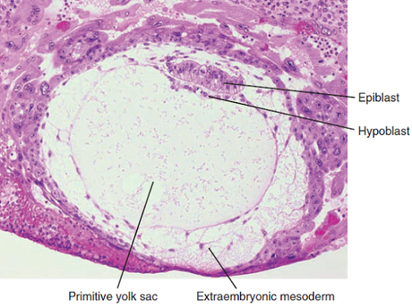 El disco bilaminar germinativo y el endometrio durante los días 11-12 de gestación