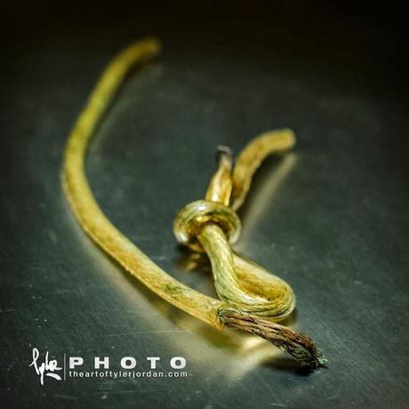 Objetos extraidos del pene de una persona por un Urologo