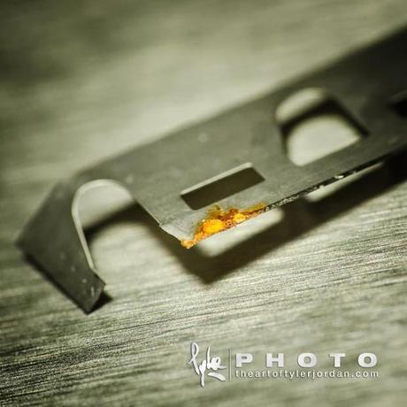 Objetos extraidos del pene de una persona por un Urologo