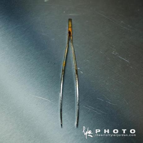 Objetos extraidos del pene de una persona por un Urologo