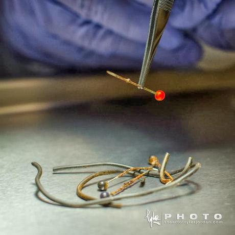 Objetos extraidos del pene de una persona por un Urologo