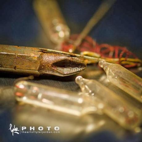 Objetos extraidos del pene de una persona por un Urologo