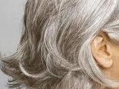 Todo sobre canas: causas, mitos consecuencias