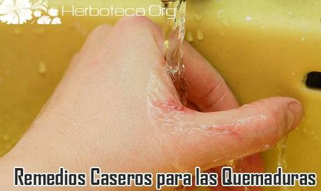 Remedios caseros para las Quemaduras