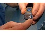 Cuando colocar Implante Coclear