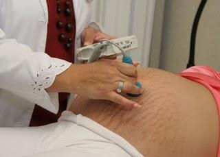 Clínica de embarazo logra 90 por ciento de éxito en gestación de alto riesgo