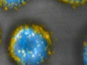 Nanomedicina: Nuevo método contra cáncer