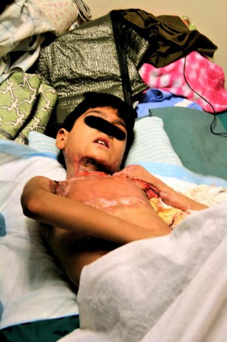 Crónicas afganas: Daños colaterales