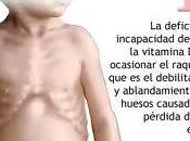 Deficit Vitamina lleva Cancer