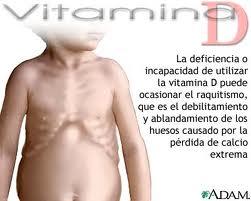 Un Deficit de Vitamina D lleva a Cancer