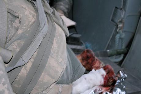 pies Crónicas afganas: Morir en Afganistán