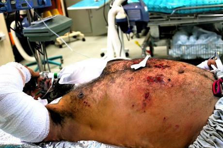 Metralla Crónicas afganas: Morir en Afganistán