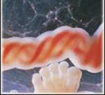 UNIDADES DE SANGRE DEL CORDÓN UMBILICAL