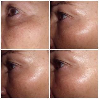 Endocare Tensage endocare tensage serum