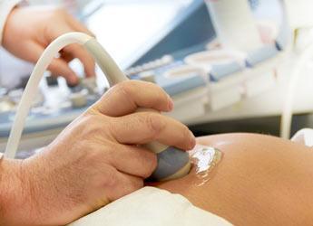 ¿Qué es una Ecografía 4D? Ecografía 4D