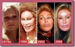 images 2 thumb Cirugía estética, desastres de famosos 