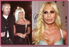 1456387 640px thumb Cirugía estética, desastres de famosos 