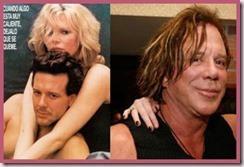 1456384 640px thumb Cirugía estética, desastres de famosos 