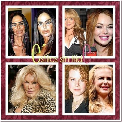 cats thumb14 Cirugía estética, desastres de famosos 