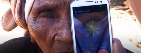 Detecta problemas oculares con peek peek