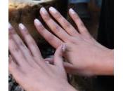 Vitamina Biotina, vitamina Belleza excelencia.