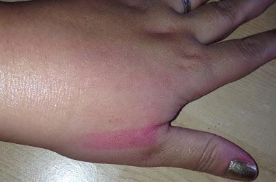 Mis labiales de Invierno