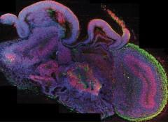 Los hitos científicos del 2013 de Science ¬–que no los míos…-