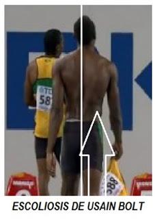 LESIONES MÁS HABITUALES DENTRO DEL ENTRENAMIENTO DE PESAS