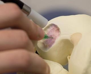 eHealth para reescribir la cirugia en la Medicina Regenerativa.