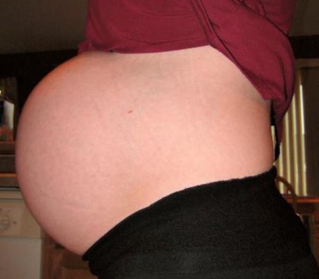 Rotura del saco amniótico