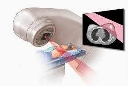 La radioterapia en el cáncer de mama