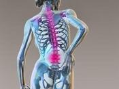 Tratamiento natural lumbago