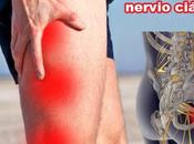 casos dolores ciática ataques ciática.