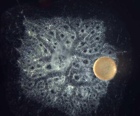 estornudo de la esponja