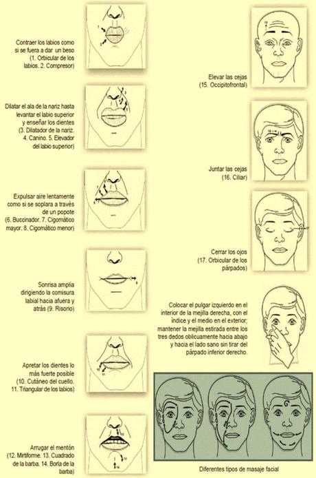 Parálisis facial