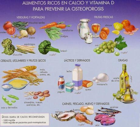 Formas de prevenir la osteoporosis