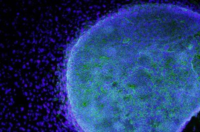 Investigadores desbloquean un nuevo medio de cultivo de células madre intestinales