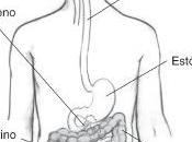 Hemorragia tracto digestivo